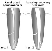 enododoncja