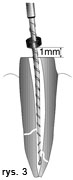 endodoncja