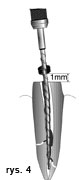 endodoncja