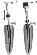 endodoncja