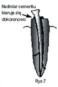 endodoncja