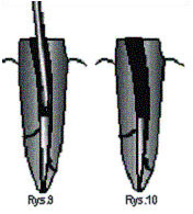endodoncja
