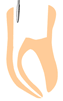 enododoncja