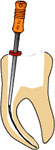 enododoncja