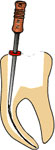 enododoncja