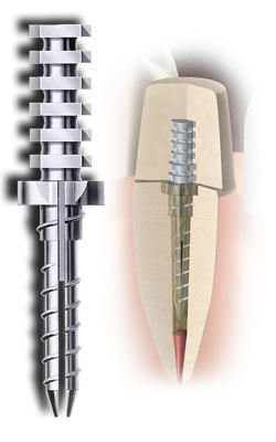 flexi-flange