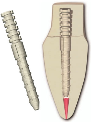 flexi-post fiber