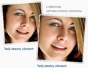 czym jest lumismile